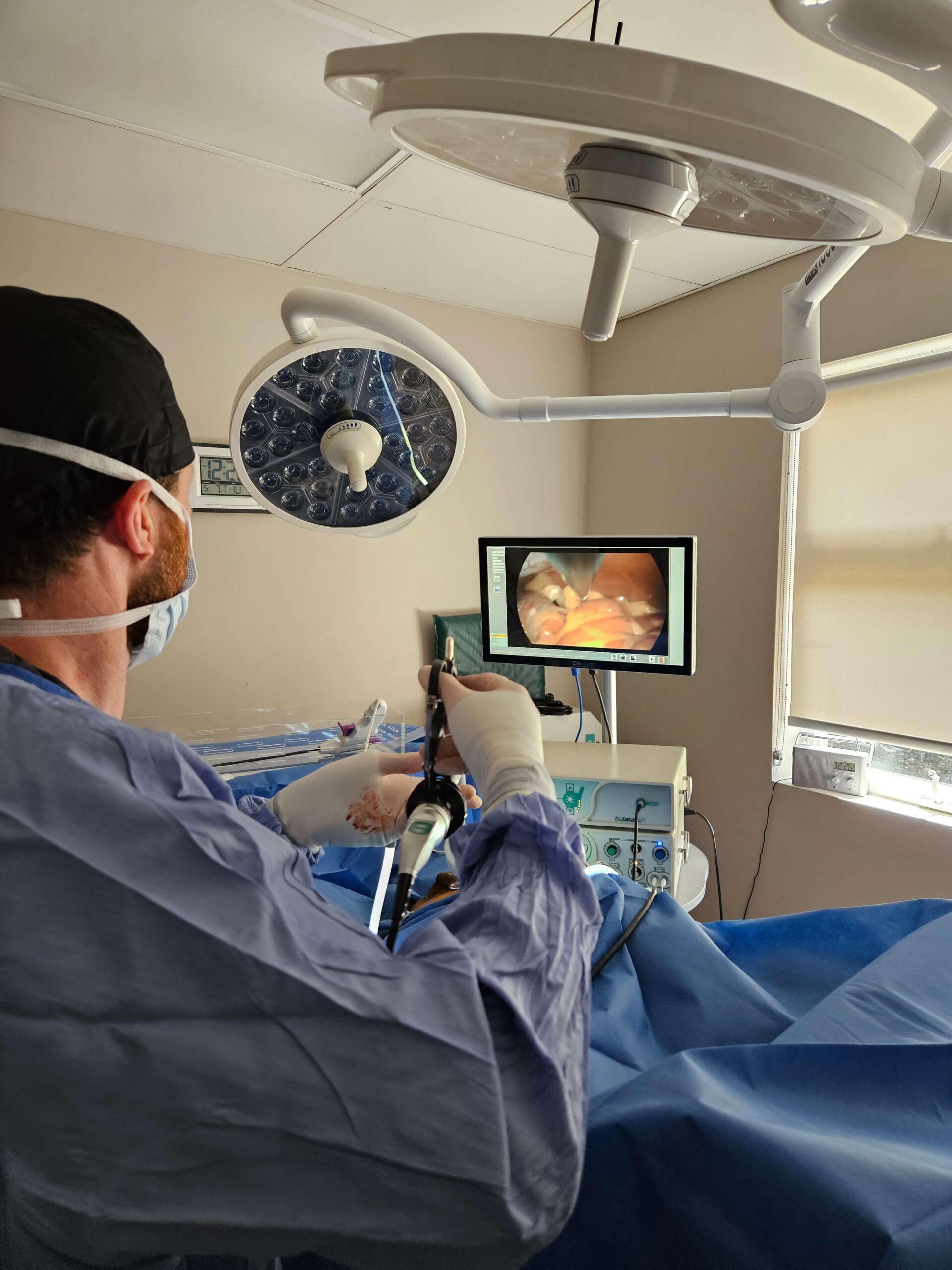 Laparoscopic Procedures